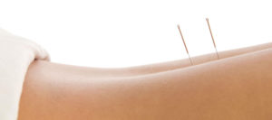 Acupuncture-Atlanta-Chiropractic-Group