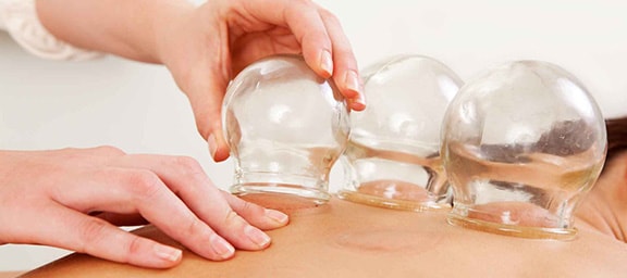 Cupping-atlanta-chiropractor